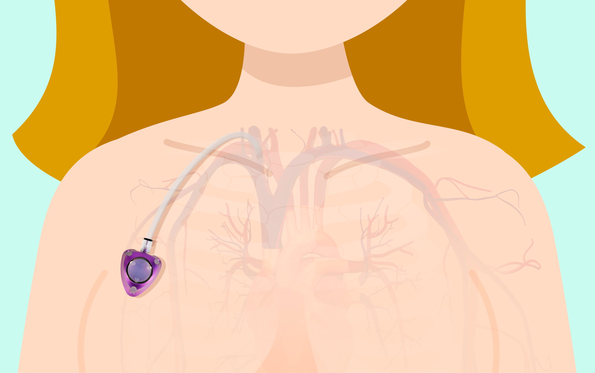 Clarice, personagem para campanha BD Brasil sobre câncer de mama (via GPeS)